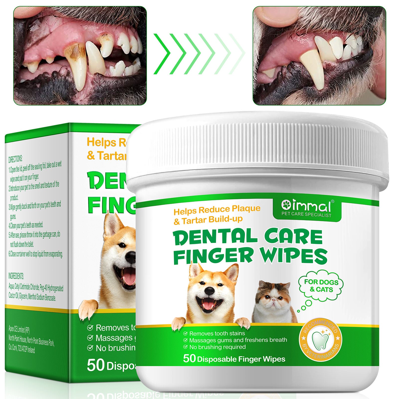 Finger Wipes